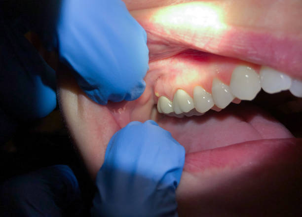  Blue Mound, TX Emergency Dentist Pros